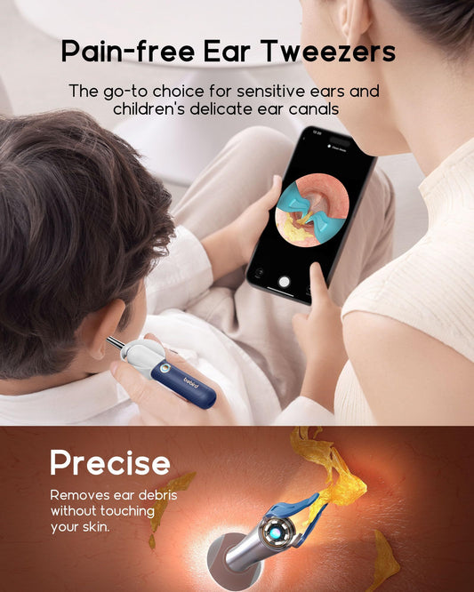 BeBird Smart Wireless Endoscope Earpick Suit